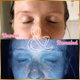 The Epiphany™ - The Original At-Home Skin Analyzer